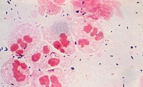 Chlamydia psittaci - возбудитель хламидиоза под микроскопом