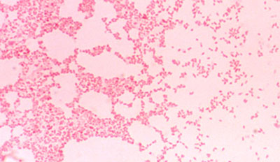 бруцела бактерии под микроскопом